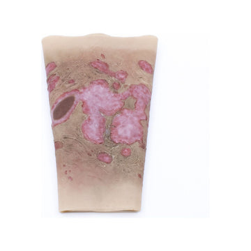 TRAUMASIM Wearable Large Burn - Forearm