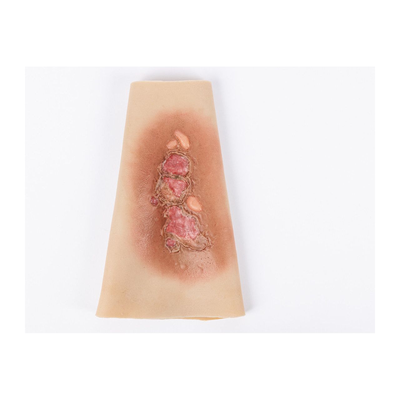 TRAUMASIM Wearable Small Burn - Forearm